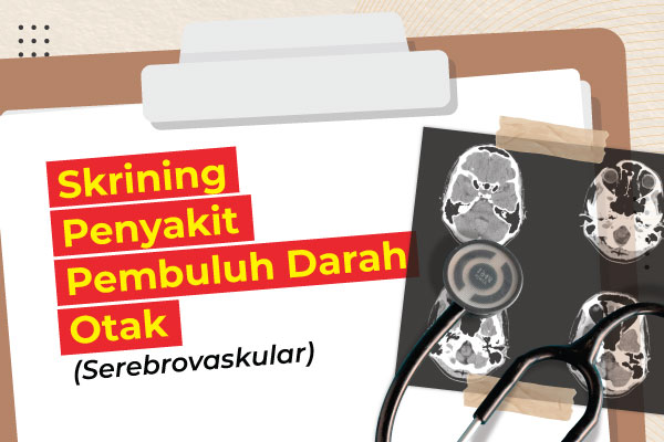 Paket MCU Skrining Penyakit Pembuluh Darah Otak Medical Check Up